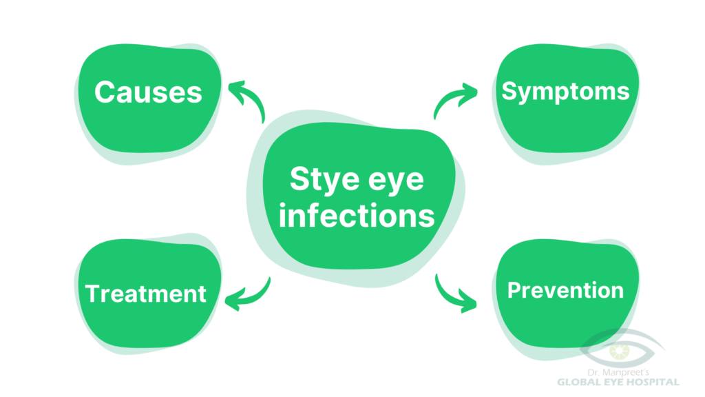 Causes, Symptoms, Treatment and prevention of Stye eye infections