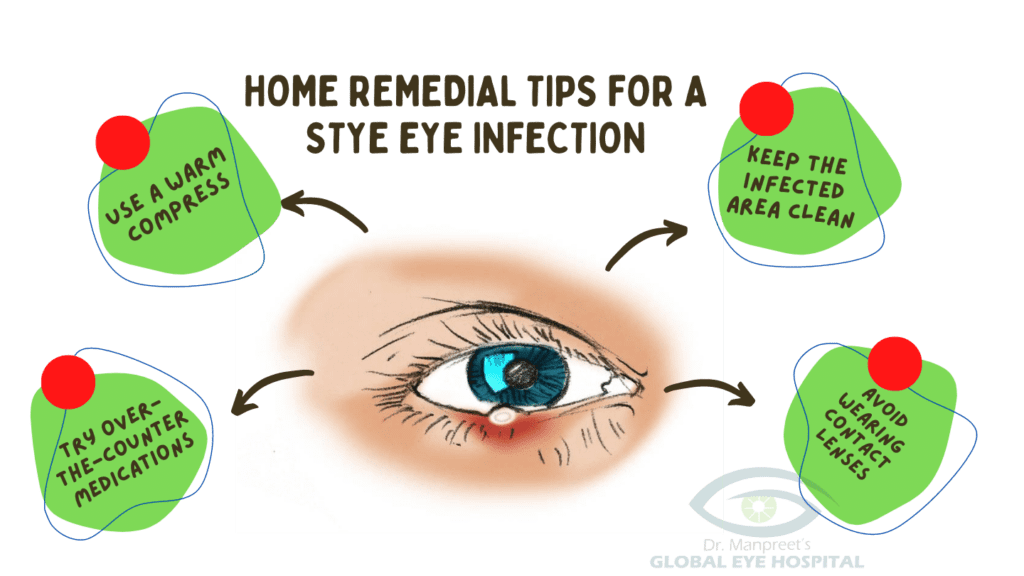 Home remedial tips for a stye eye infection