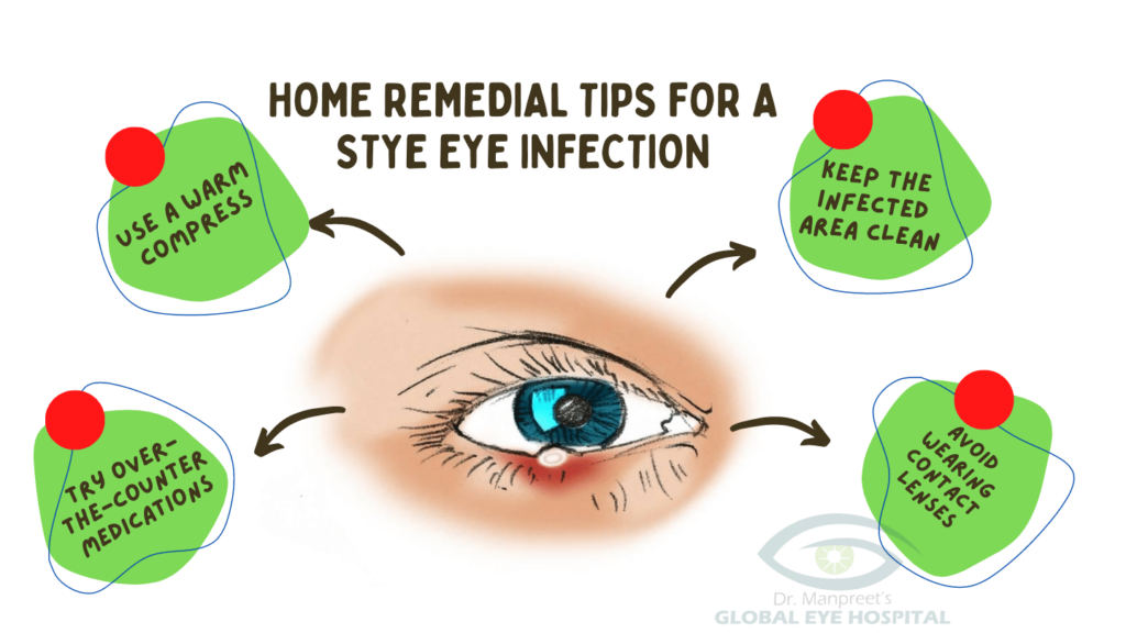 Home remedial tips for a stye eye infection