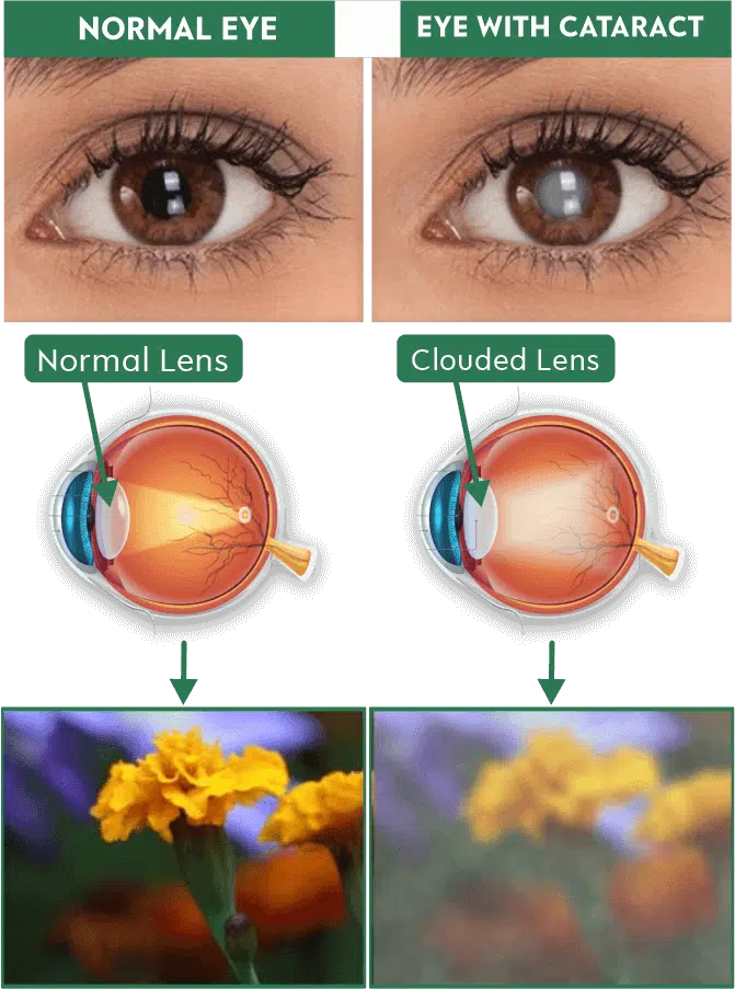 dr manpreet global eye hospital