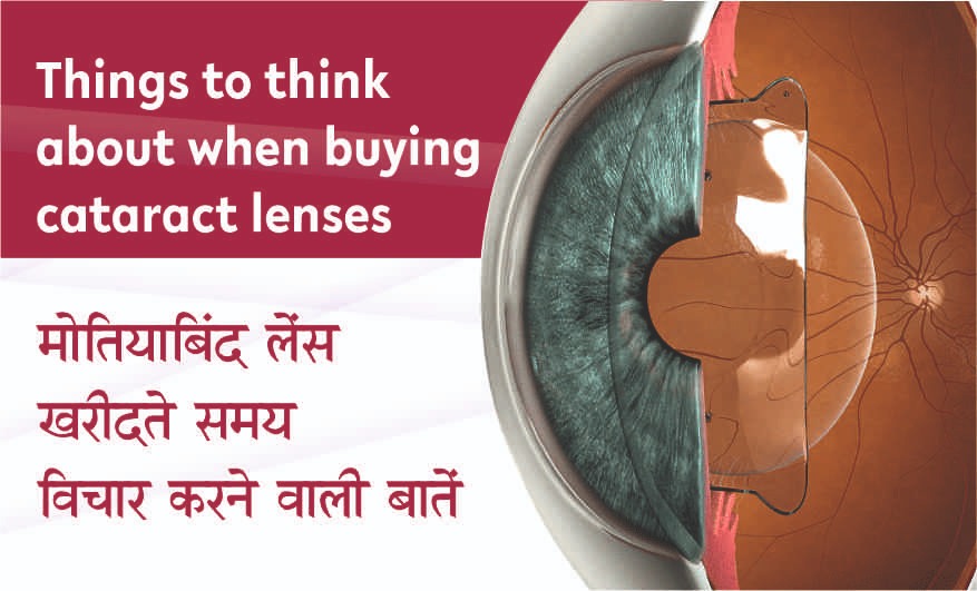 Things to think about when buying cataract lenses: