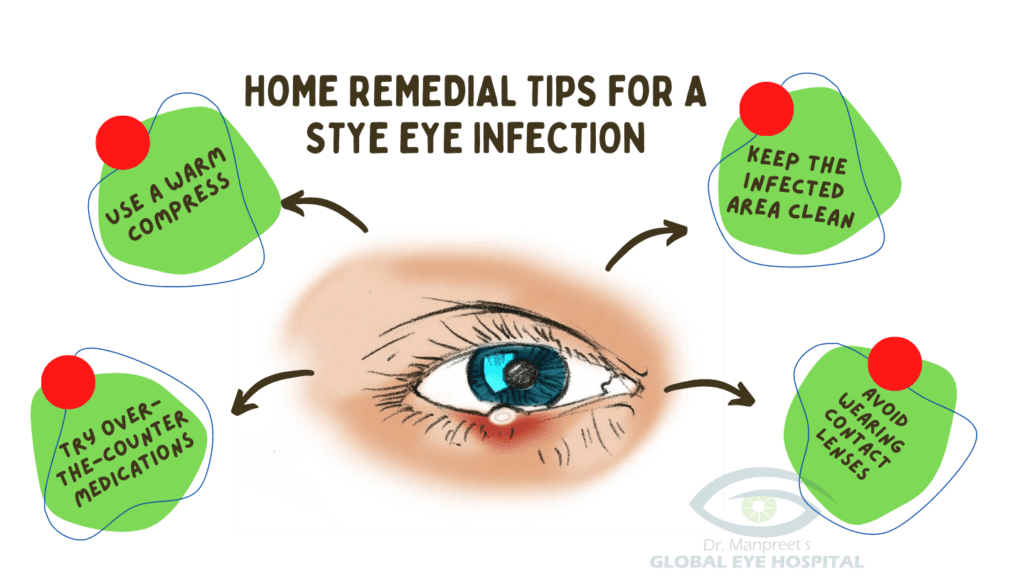 Causes Symptoms Treatment And Prevention Of Stye Eye Infections 