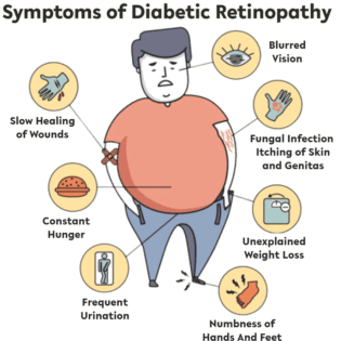 Diabetic Retinopathy | Causes, Symptoms, & Treatment - Global Eye ...