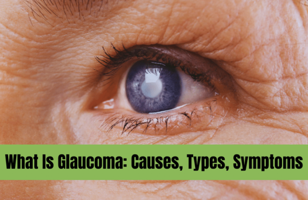 What Is Glaucoma
