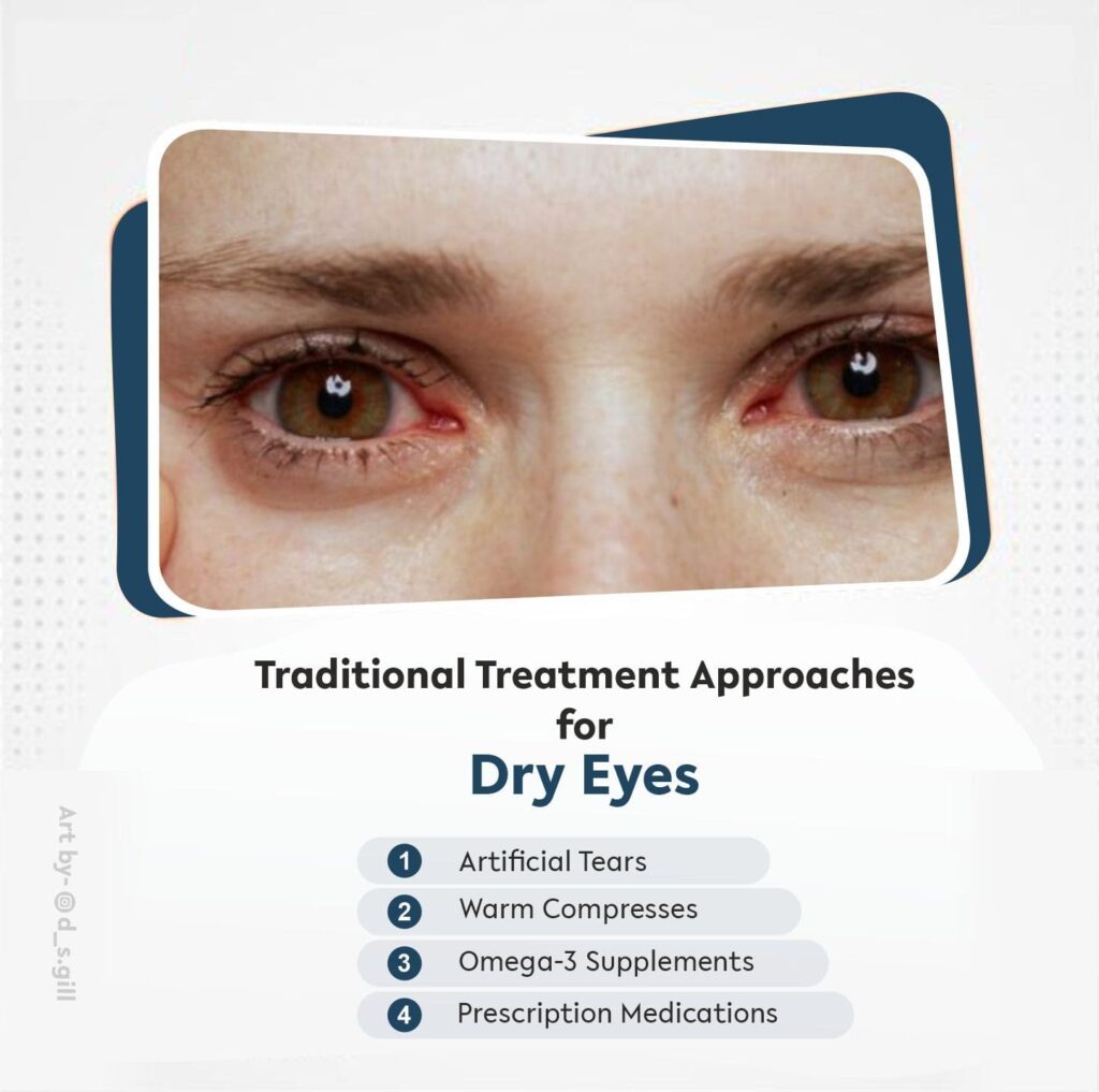 Traditional Treatment Approaches for Dry Eyes