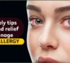 Seasonal Eye Allergy
