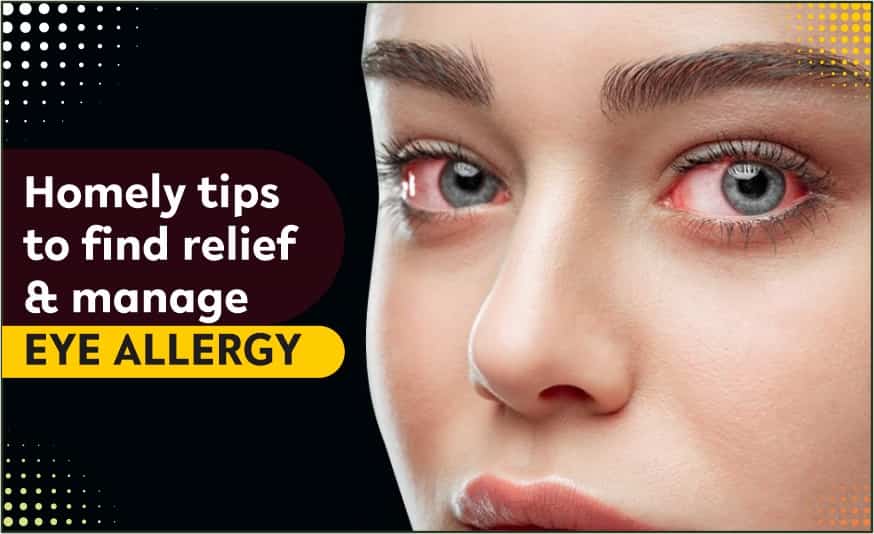 seasonal allergies eyes