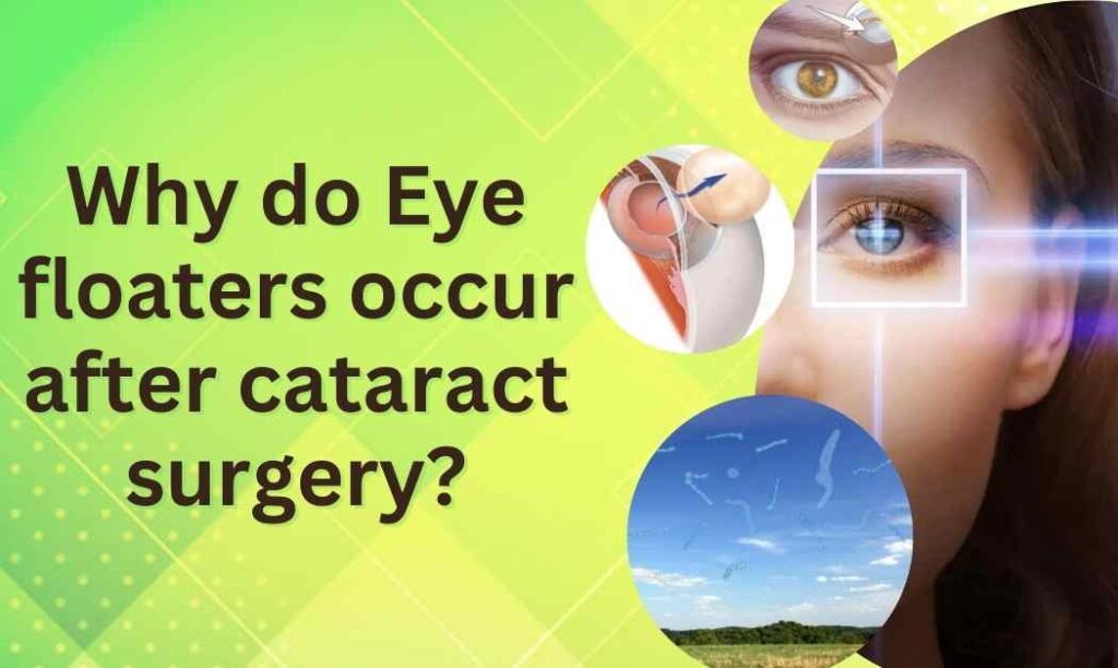 ye floaters occur after cataract surgery