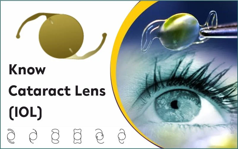 Know Cataract Lens types